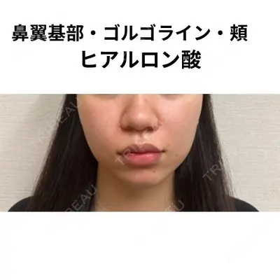 おおたかの森ビューティークリニック 海野 芙美香医師の症例