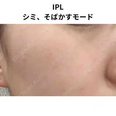 おおたかの森ビューティークリニックの症例