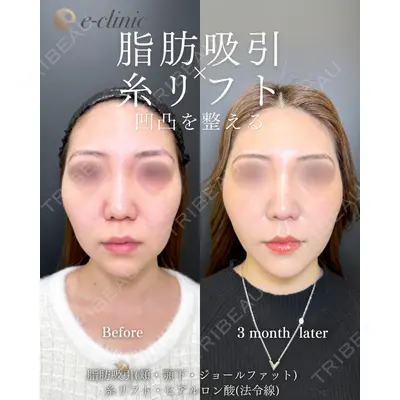 eクリニック 福岡院 伊藤 渉医師の症例