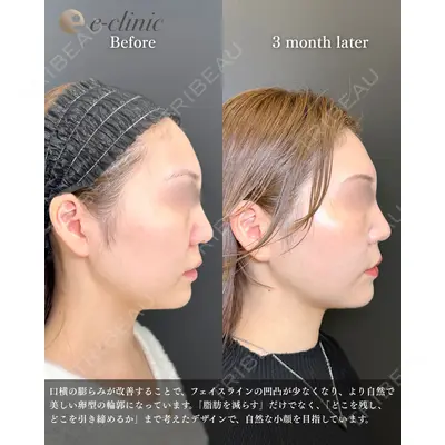 eクリニック 福岡院 伊藤 渉医師の症例