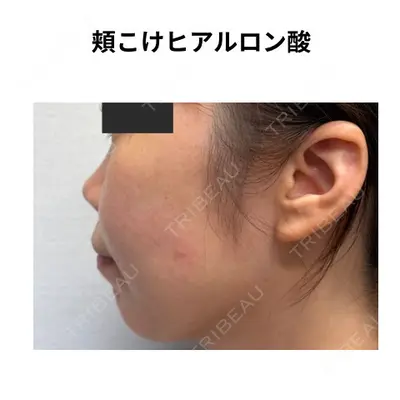 おおたかの森ビューティークリニック 海野 芙美香医師の症例