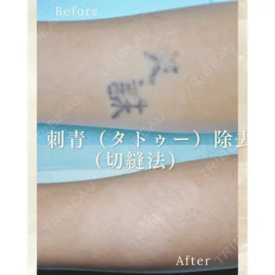 郡山タウン形成外科クリニック 石原 信浩医師の症例