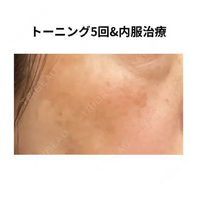 おおたかの森ビューティークリニックの症例