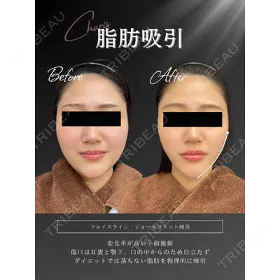 CHARIS BEAUTY CLINIC 木畑智哲医師の症例