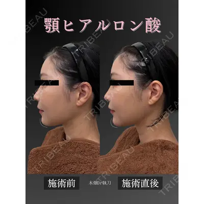 CHARIS BEAUTY CLINICの症例