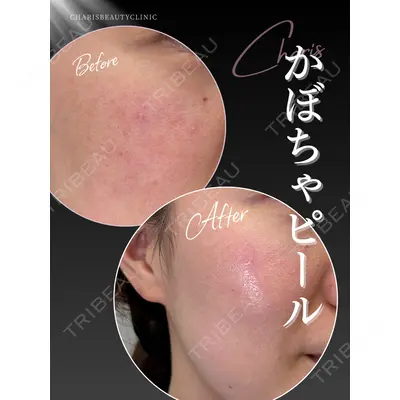CHARIS BEAUTY CLINICの症例