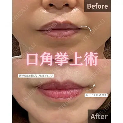 CHARIS BEAUTY CLINIC 木畑智哲医師の症例