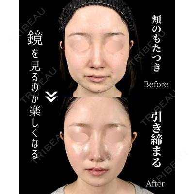 新宿美容外科ネビュラクリニック 山本 紘子医師の症例