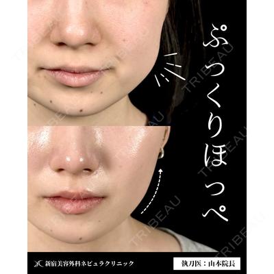 新宿美容外科ネビュラクリニック 山本 紘子医師の症例