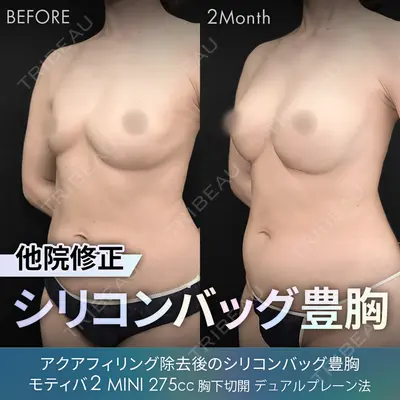 ジョウクリニック 銀座院 重本　譲医師の症例