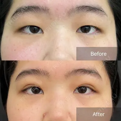 CHARIS BEAUTY CLINICの症例