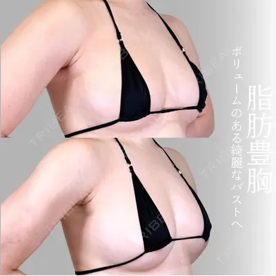 アリエル美容クリニック 横浜院 加藤 敏次医師の症例