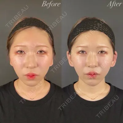 R Beauty CLINIC 名古屋院 木村 尚大医師の症例