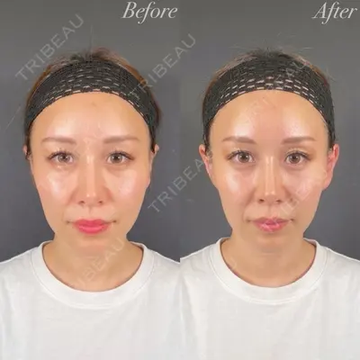 R Beauty CLINIC 名古屋院 木村 尚大医師の症例