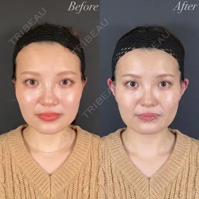 R Beauty CLINIC 名古屋院 木村 尚大医師の症例