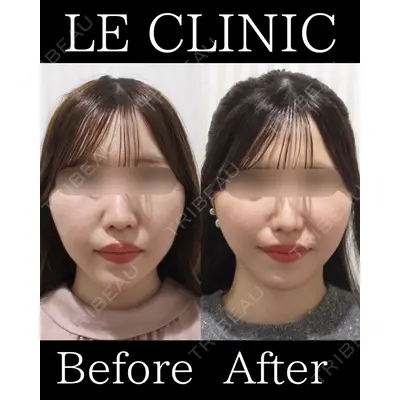LE CLINICの症例