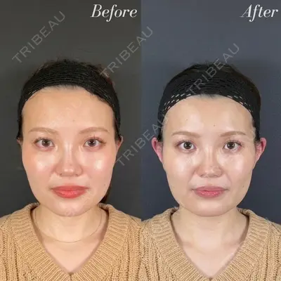 R Beauty CLINIC 名古屋院 木村 尚大医師の症例