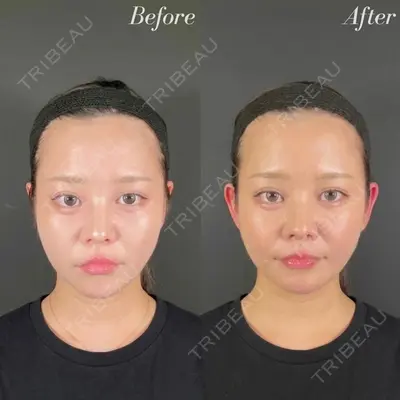 R Beauty CLINIC 名古屋院 木村 尚大医師の症例