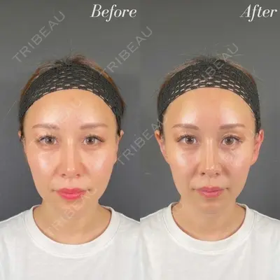 R Beauty CLINIC 名古屋院 木村 尚大医師の症例