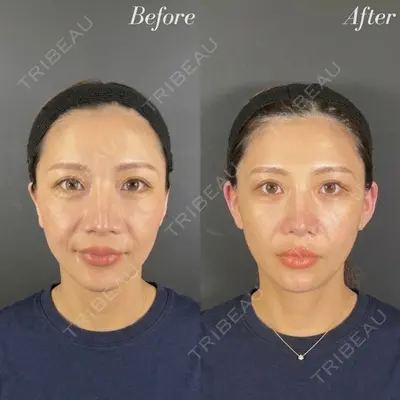 R Beauty CLINIC 名古屋院 木村 尚大医師の症例