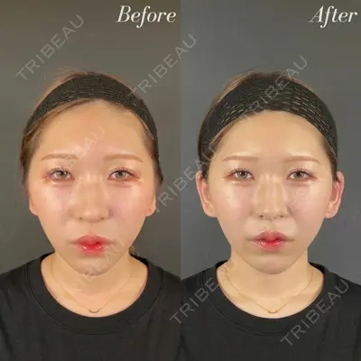 R Beauty CLINIC 名古屋院 木村 尚大医師の症例