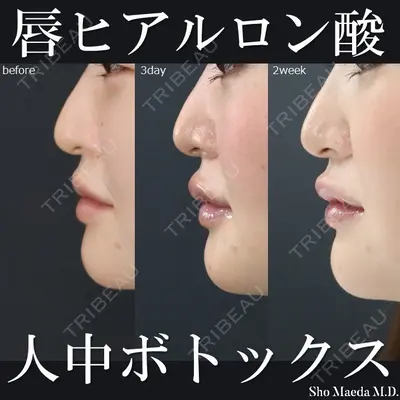 MAe Clinic 東京院 前田 翔医師の症例