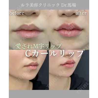 ルラ美容クリニック 岐阜院 馬場 愛理医師の症例