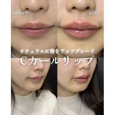 ルラ美容クリニック 岐阜院 馬場 愛理医師の症例