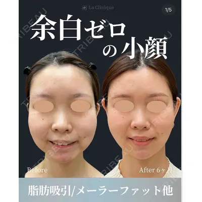 La Clinique Osaka 【ラクリニック大阪】 長瀬 ⼤蔵医師の症例
