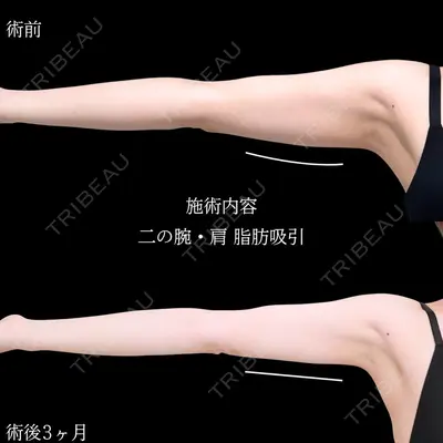 アリエル美容クリニック 横浜院 加藤 敏次医師の症例