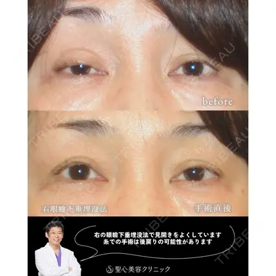 聖心美容クリニック 福岡院 美原 寿之医師の症例