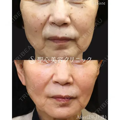 聖心美容クリニック 福岡院 美原 寿之医師の症例