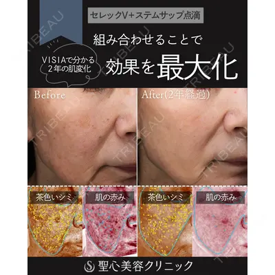 聖心美容クリニック 福岡院 美原 寿之医師の症例