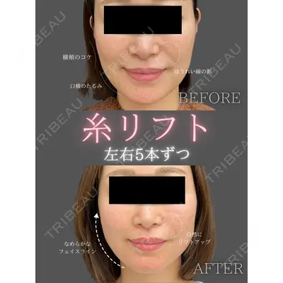 CHARIS BEAUTY CLINICの症例