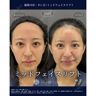 LA MER CLINICの症例