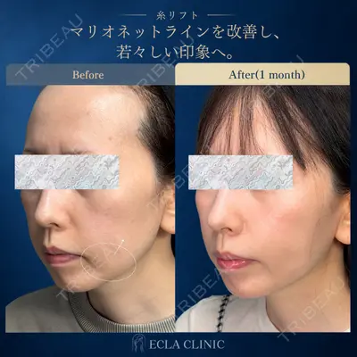 ECLA CLINIC (エクラクリニック) 緒方 善孝医師の症例