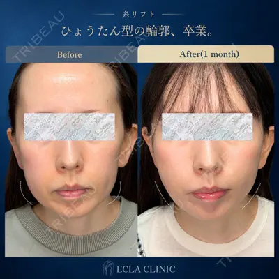 ECLA CLINIC (エクラクリニック) 緒方 善孝医師の症例