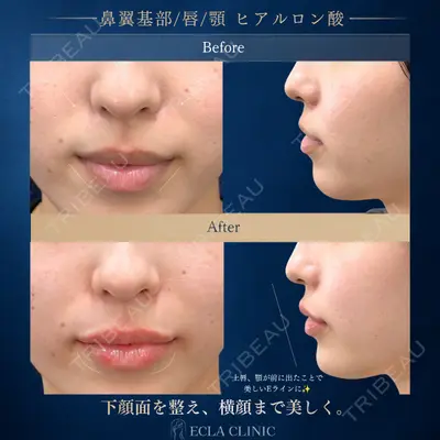 ECLA CLINIC (エクラクリニック) 緒方 善孝医師の症例