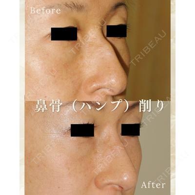 郡山タウン形成外科クリニック 石原 信浩医師の症例