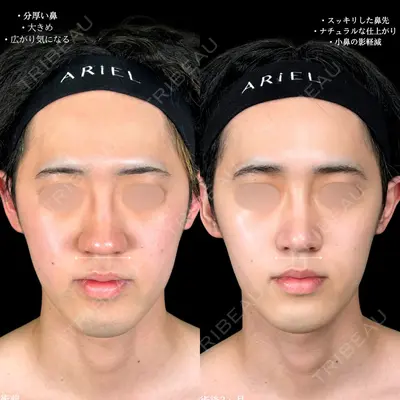 アリエル美容クリニック 大宮院 阪野 一世医師の症例