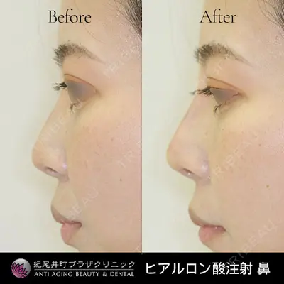 紀尾井町プラザクリニックの症例