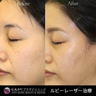 紀尾井町プラザクリニックの症例