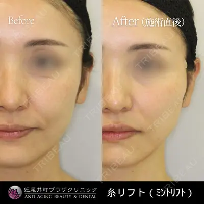 紀尾井町プラザクリニックの症例