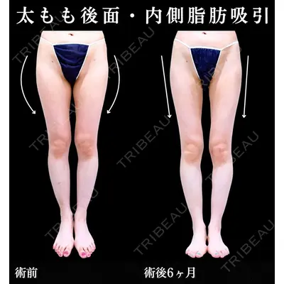 アリエル美容クリニック 横浜院 加藤 敏次医師の症例
