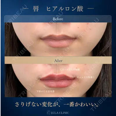 ECLA CLINIC (エクラクリニック) 緒方 善孝医師の症例