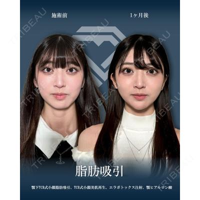 TCB東京中央美容外科 山梨甲府駅前院の症例