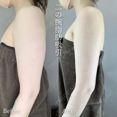 TCB東京中央美容外科 佐賀院の症例