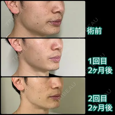 東京ロイヤルクリニック 桐生　超智医師の症例