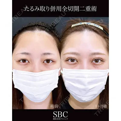 湘南美容クリニック 神戸三宮院 中川 卓医師の症例