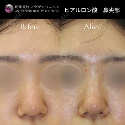 紀尾井町プラザクリニックの症例